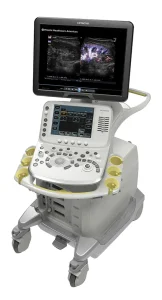 超音波診断装置 ARIETTA 70